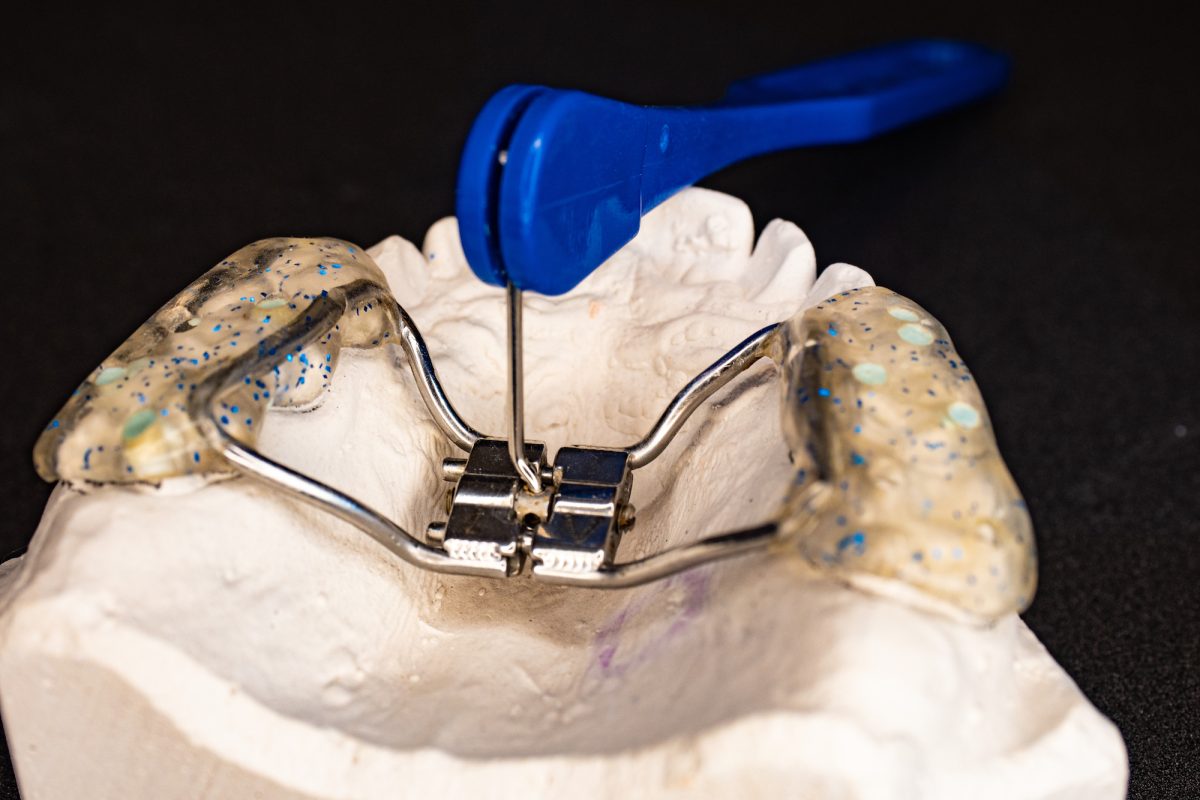 Understanding the Benefits and Process of Palate Expander